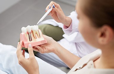 explaining-tooth-implants