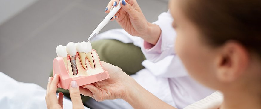explaining-tooth-implants