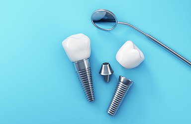 Are Dental Implants Safe?