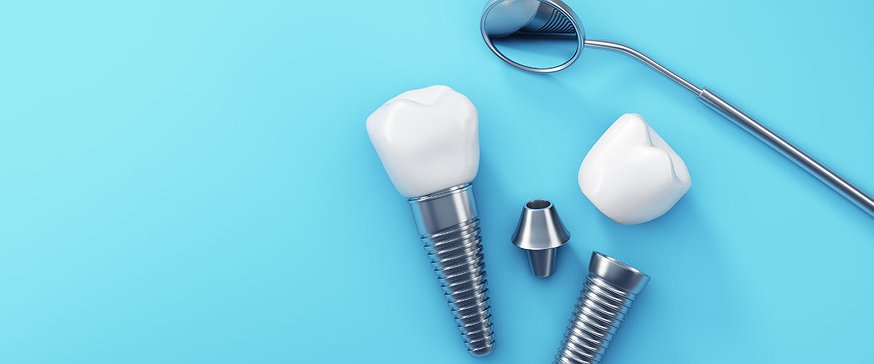 Are Dental Implants Safe?